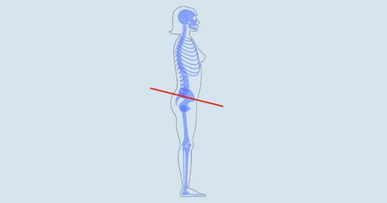 anterior pelvic tilt