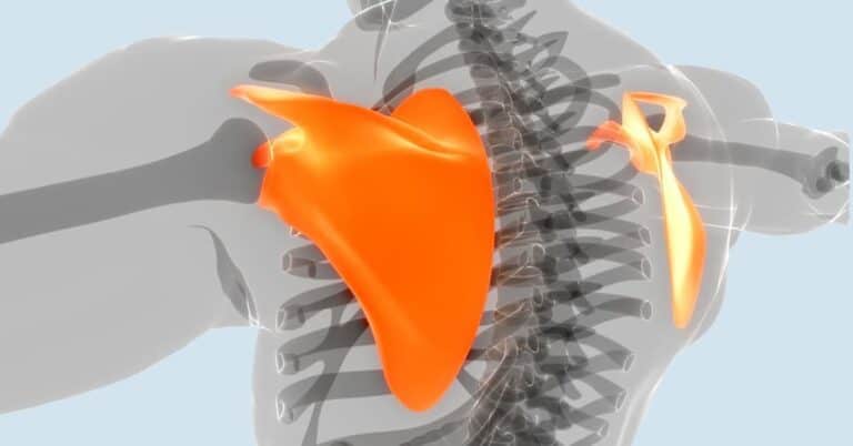 scapula winging