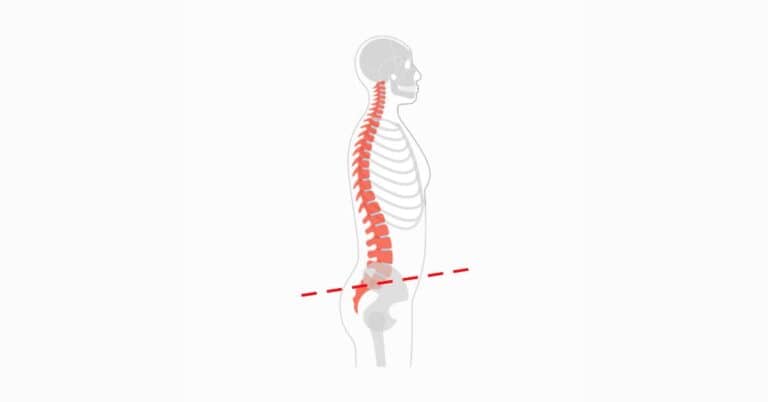 posterior pelvic tilt